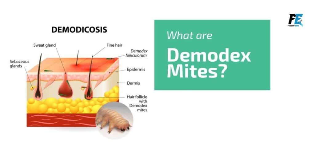 Demodex Mites