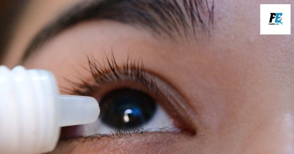 How to Treat Blepharitis from Eyelash Extensions?