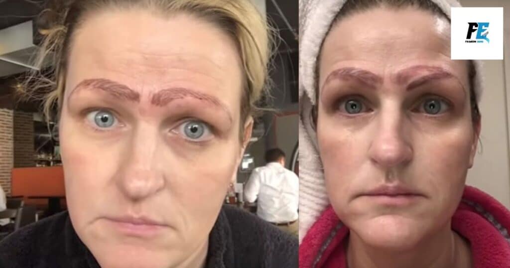 Can you fix lousy eyebrow microblading?